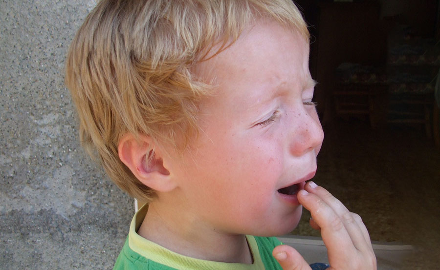 Przytrzaśnięty palec u dziecka: Jak leczyć? Kiedy udać się do lekarza?