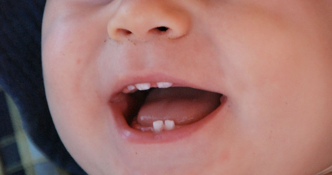Kolejność wychodzenia zębów u dzieci