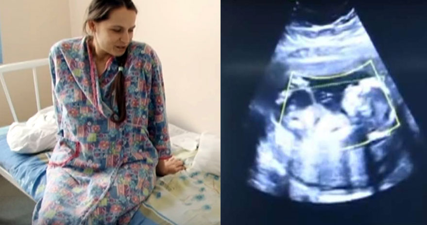 Pierwsze USG zrobiła dopiero w 41 tygodniu ciąży, ponieważ nie wierzyła w medycynę. To mogło skończyć się tragicznie!