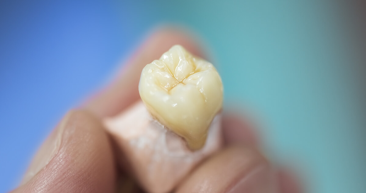 Sennik: Zęby – Co oznacza sen o zębach?