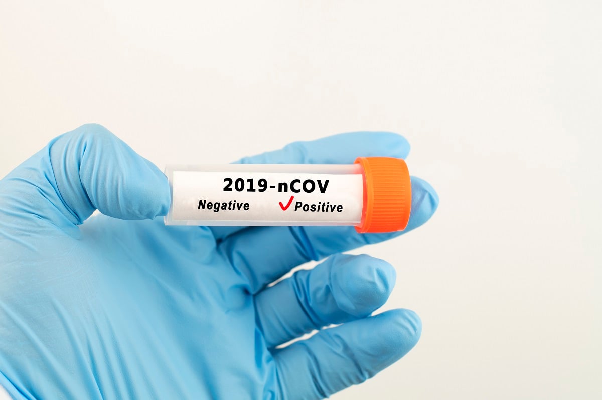 Szybki test na przeciwciała koronawirusa: nowy sposób na wykrycie COVID-19?