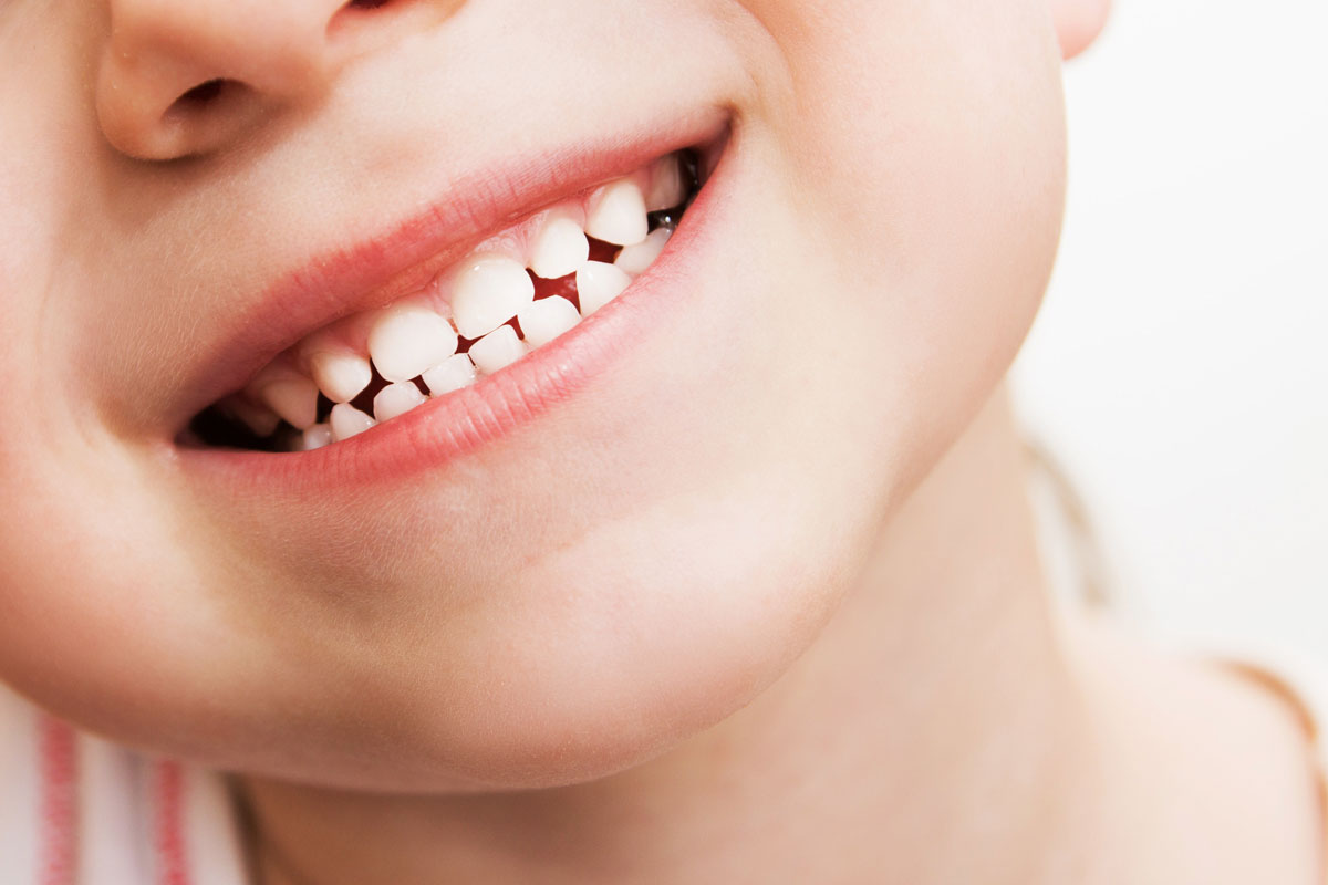 Zęby mleczne: dlaczego rosną w wieku dziecięcym, a potem wypadają?
