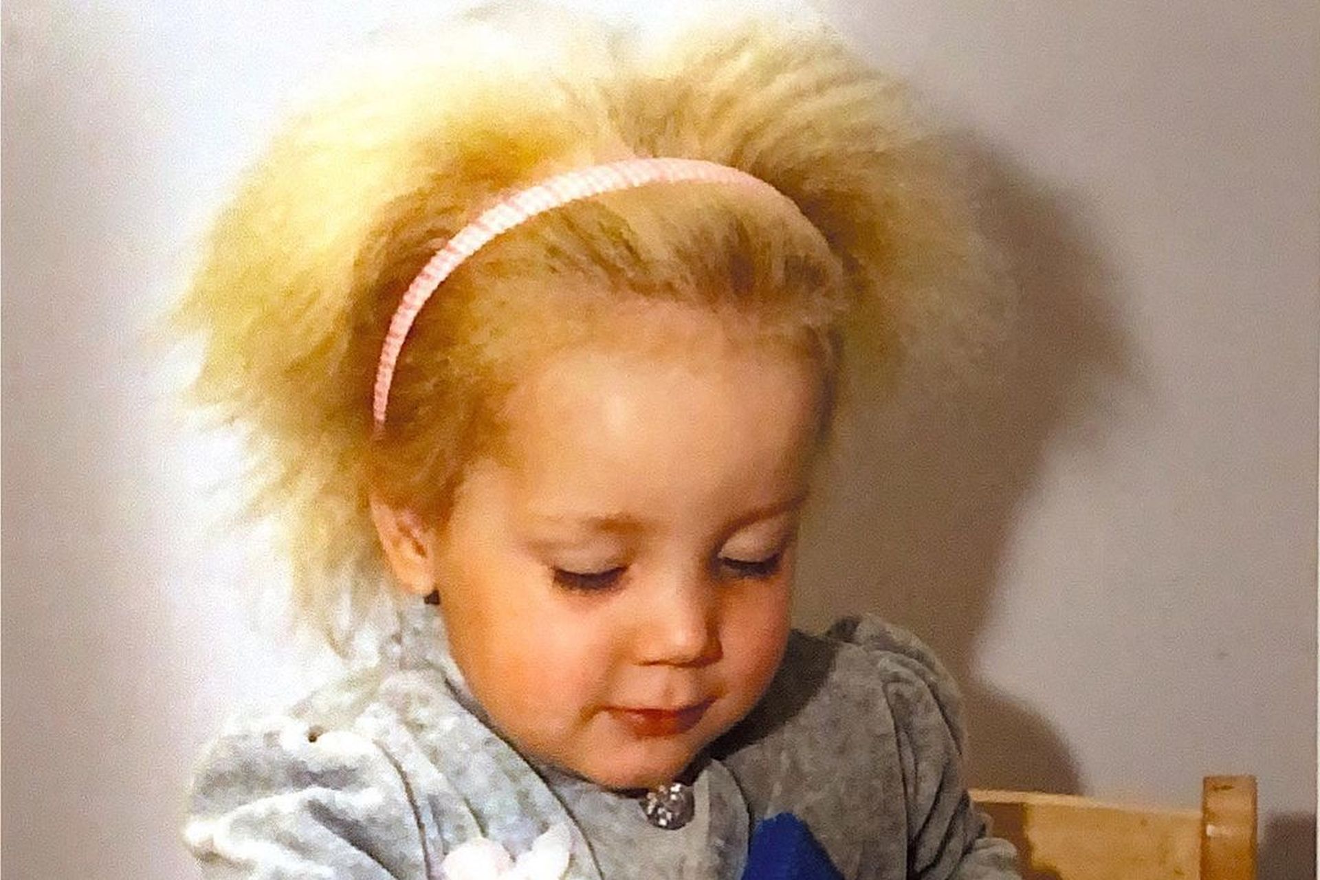 Dziewczynka z “włosami Einsteina” ma już 13 lat! Jak Shilah zmieniła się przez lata?
